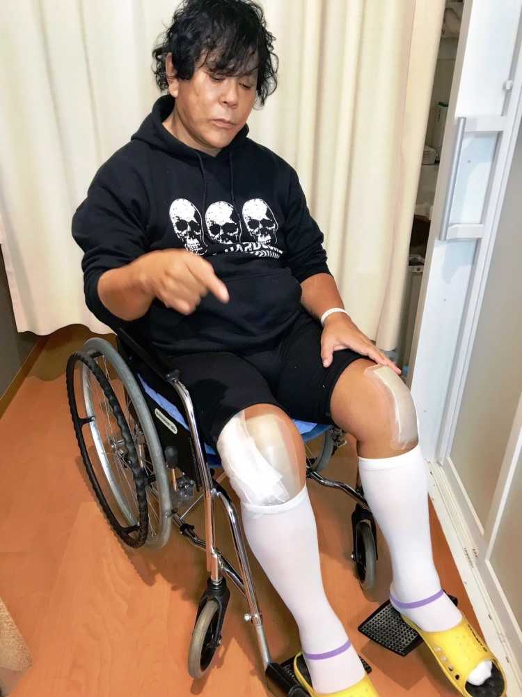 大仁田厚　両膝の人工関節手術成功　リング復帰のメド立たず、米自主興行延期か