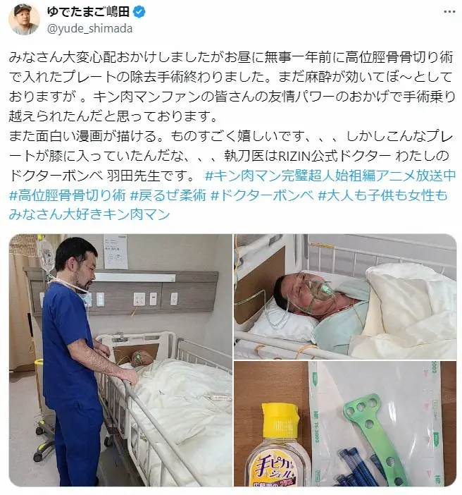 【画像・写真】ゆでたまご嶋田隆司氏　高位脛骨骨切り手術のプレートを除去「また漫画が描ける…ものすごくうれしい」