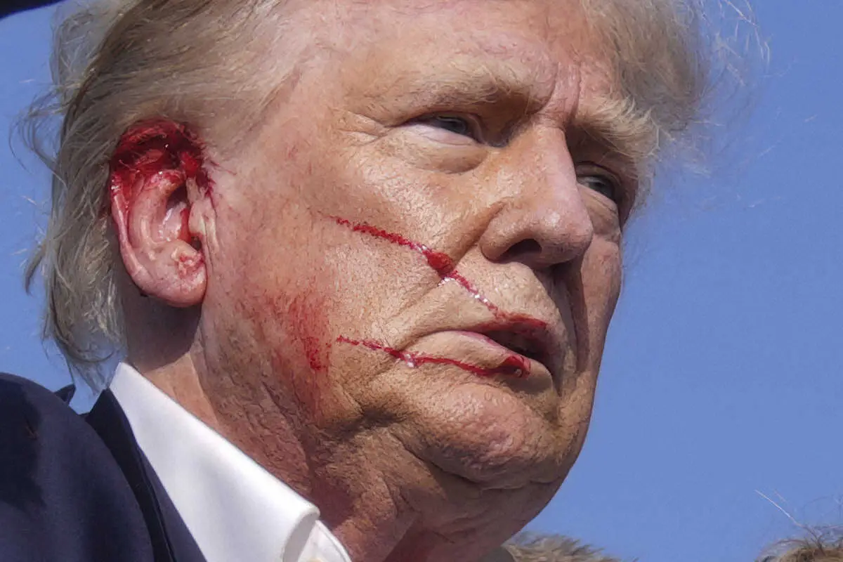 耳の傷口から流血するトランプ前大統領（AP）