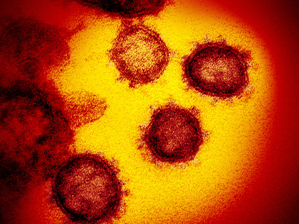 新型コロナウイルスの電子顕微鏡写真（米国立アレルギー感染症研究所提供）